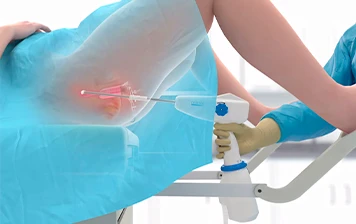 Imagem representativa: Cauterização química ou eletrocauterização de lesões vulvares, vaginais e do colo uterino
