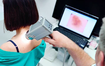 Imagem representativa: Dermatoscopia digital e mapeamento corporal (fotofinder)