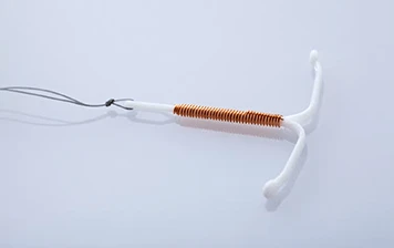 Imagem representativa: Implante e remoção de DIU não hormonal