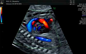Cuidado e acolhimento na Cardioclin